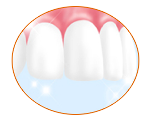 フッ素を歯の表面に塗布